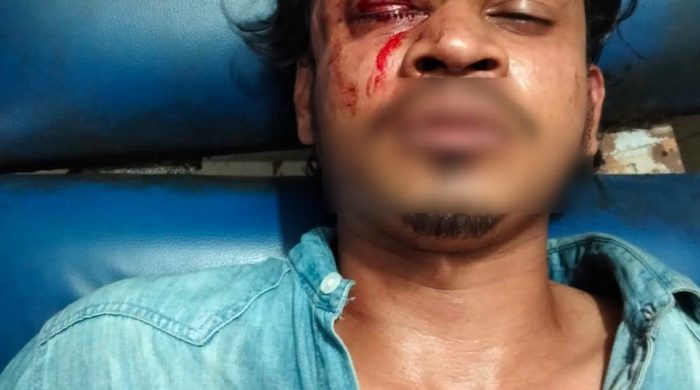 রাণীশংকৈলে ফুচকা হাউজে অসামাজিক কাজের প্রতিবাদ করায় যুবককে কুপিয়ে জখম-থানায় অভিযোগ