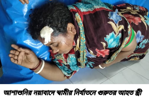 আশাশুনির নয়াবাদে স্বামীর নির্মম নির্যাতনে স্ত্রী হাসপাতালে, মাথা ফেটে সেলাই, শরীরের বিভিন্ন স্থানে আঘাতের চিহ্ন;
